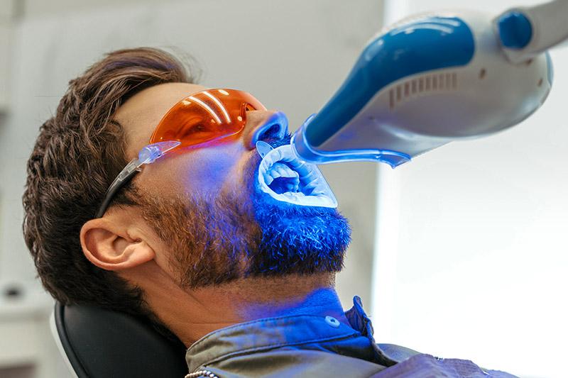 Toronto teeth whitening